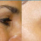 <a href=/119 class=galeria>Botox | CLIOB - Dr. Joaquin Cueto Arellanos</a>